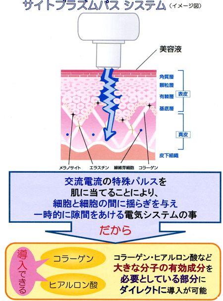 sサイトプラズマパス.jpg